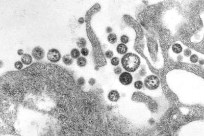A transmission electron micrograph of a number of Lassa virus virions adjacent to some cell debris. The virus, a member of the virus family Arenaviridae, causes Lassa fever.