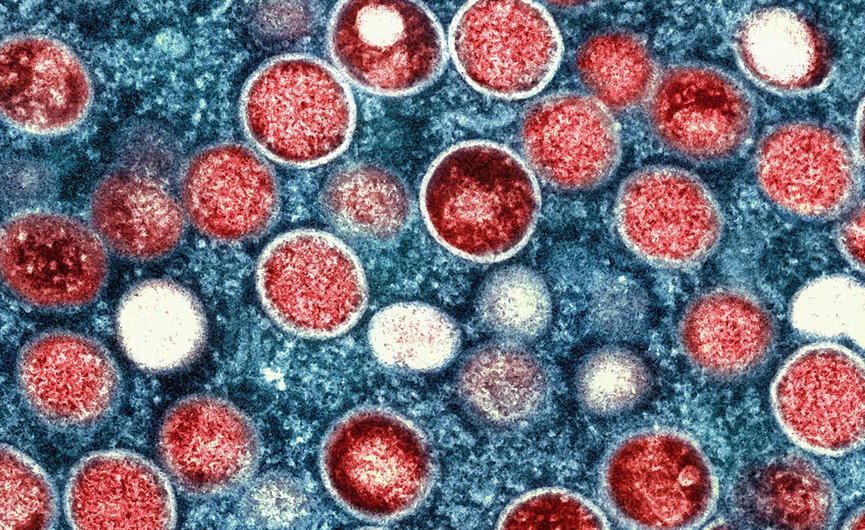 Africa: Mpox Alert thumbnail